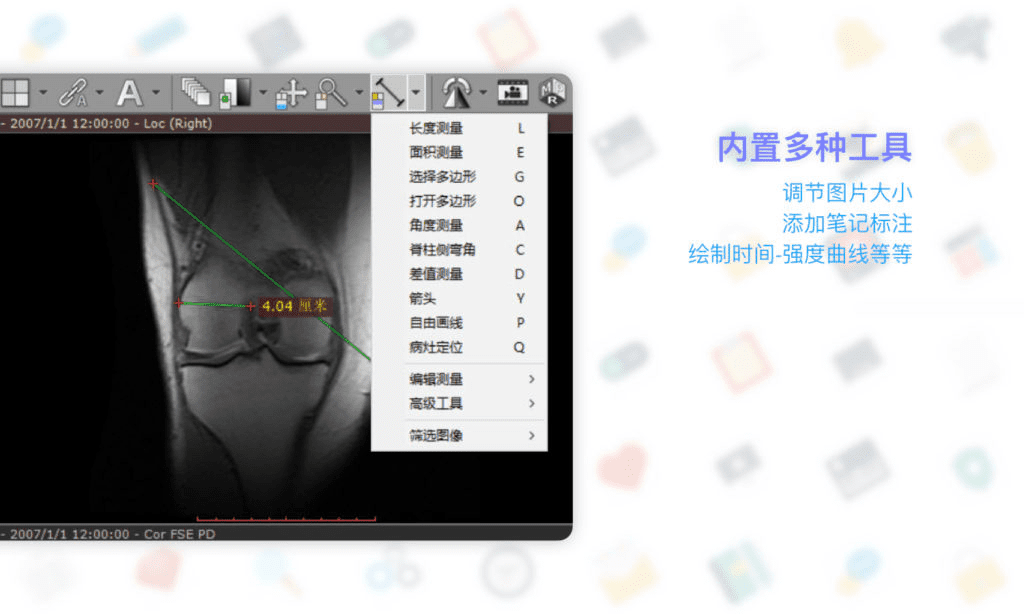 RadiAnt DICOM Viewer: 