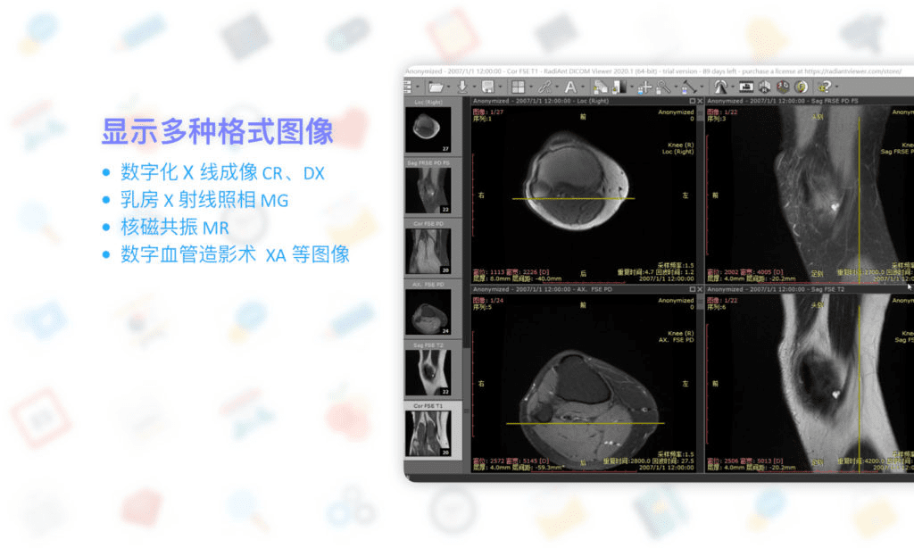 RadiAnt DICOM Viewer: 