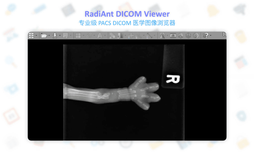 RadiAnt DICOM Viewer: 