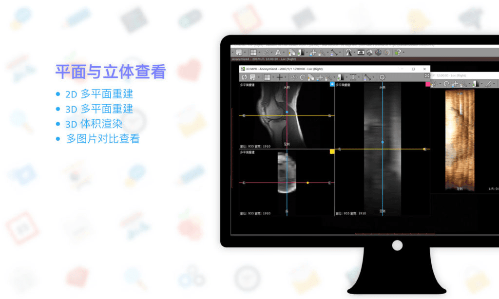 RadiAnt DICOM Viewer: 