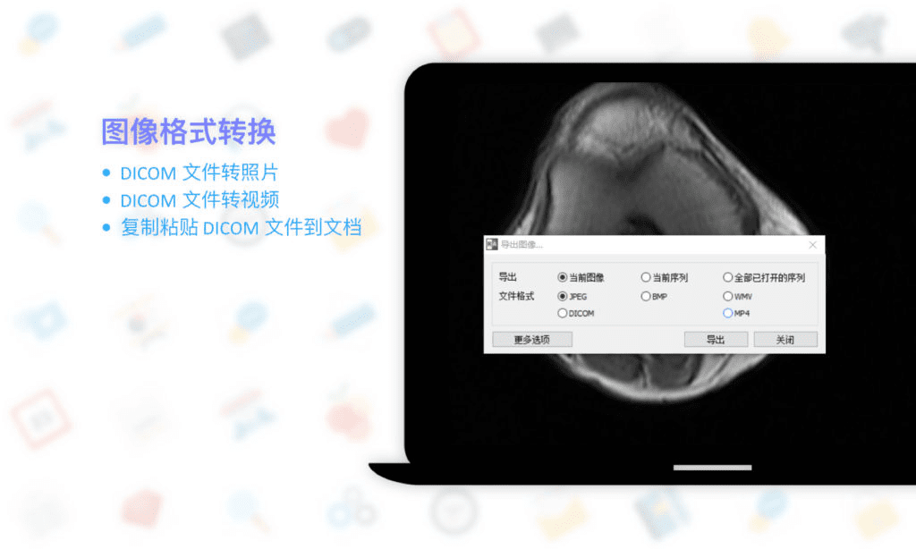 RadiAnt DICOM Viewer: 